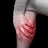 upload/articles/thumbs/240113022050gastroc tendonitis.jpg
